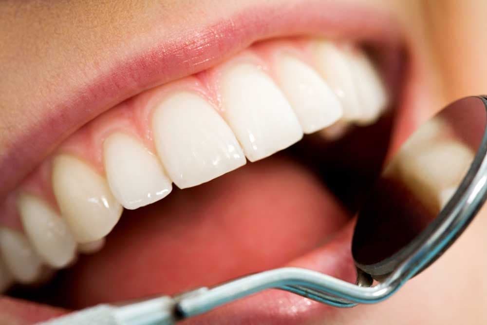 Professional Teeth Cleaning Near Me: Healthier Smile
