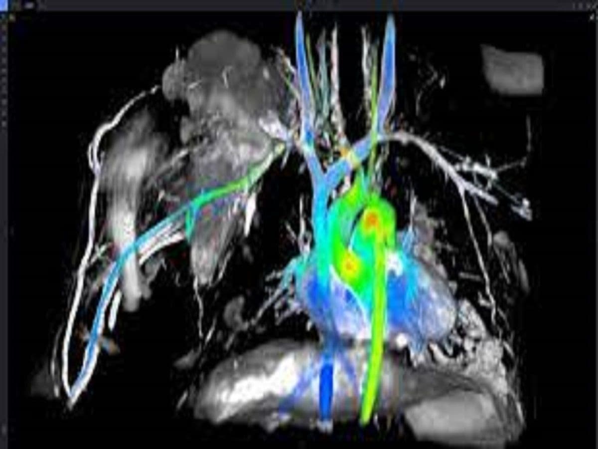 Cardiac Mri Testing Systems Market Size, Share, Growth Report