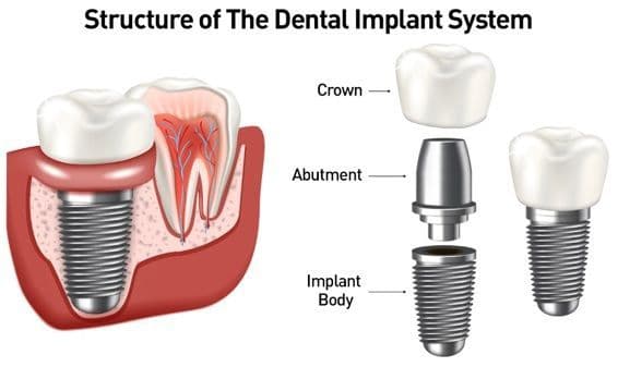 How Cosmetic Dentistry Can Enhance Your Appearance