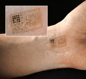 Epidermal Electronic Devices Market Regional Overview 2028
