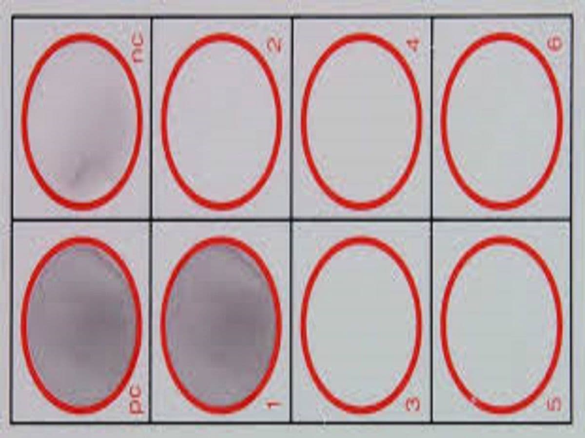 Rapid Plasma Reagin Test Market Outlook to 2028
