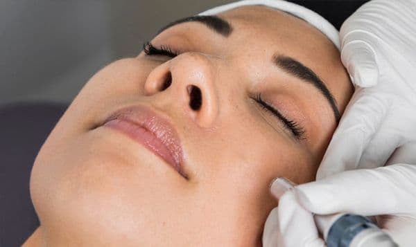 Melbourne's Changing Beauty Scene: The Role of Skin Needling