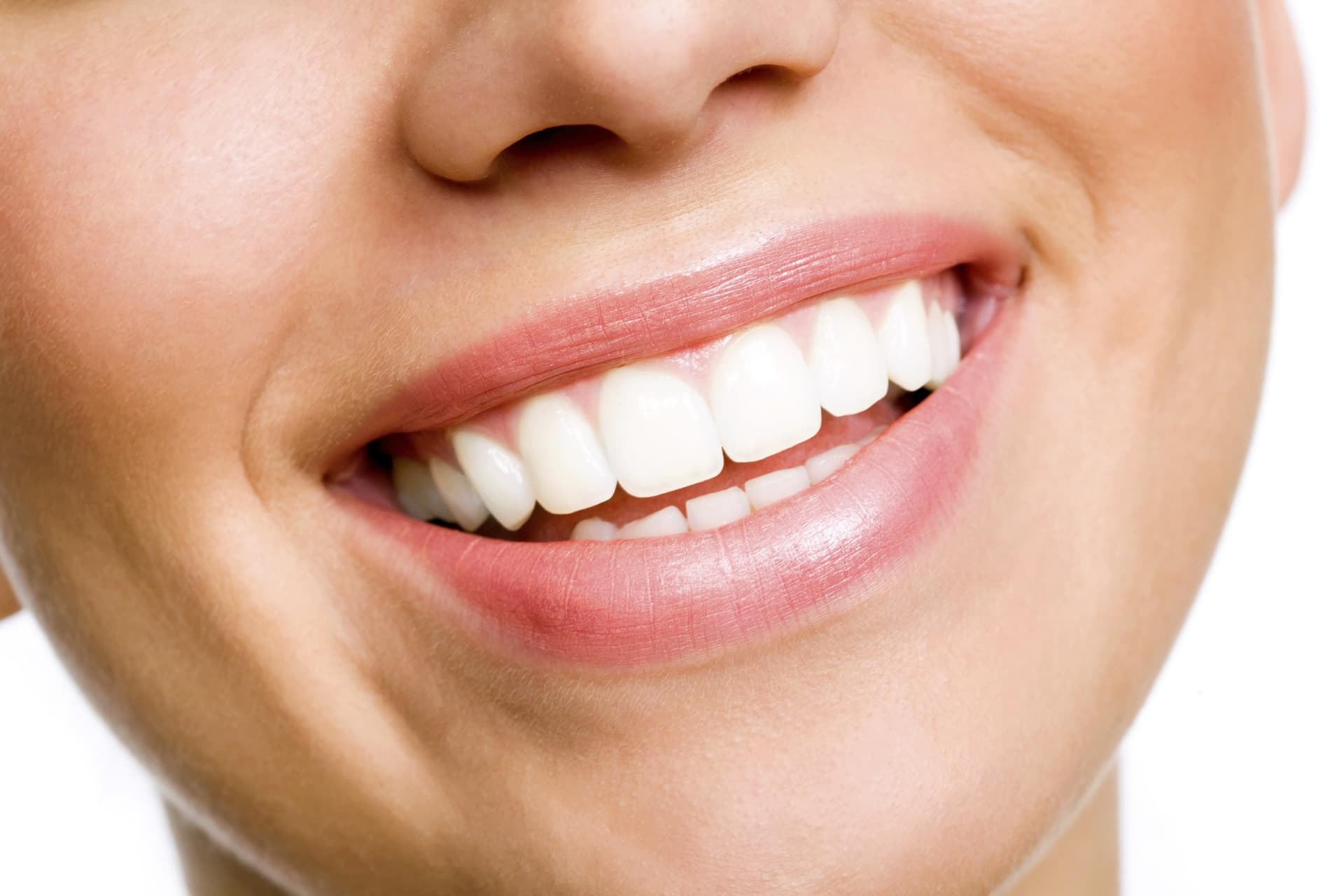 Bright Smiles: Understanding Teeth Whitening in Windsor