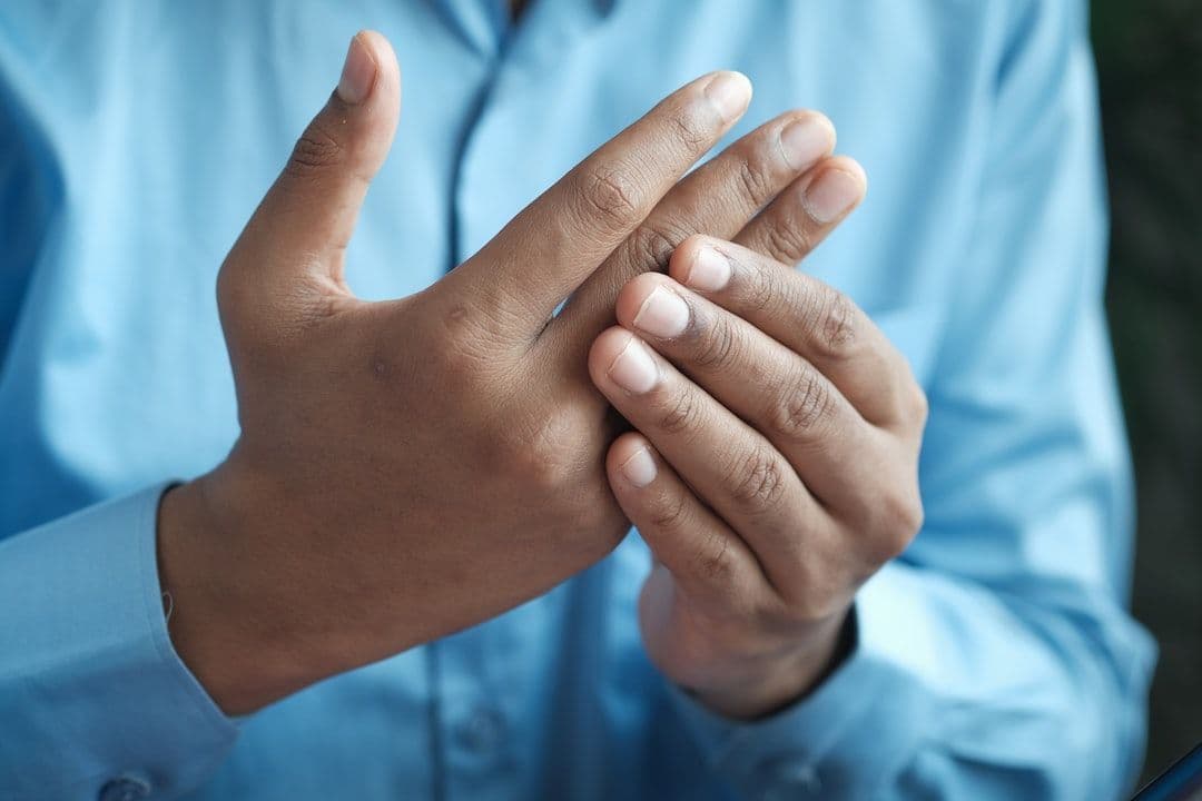 Does Cracking Your Knuckles Cause Arthritis?