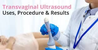 The Science Behind Transvaginal Ultrasound