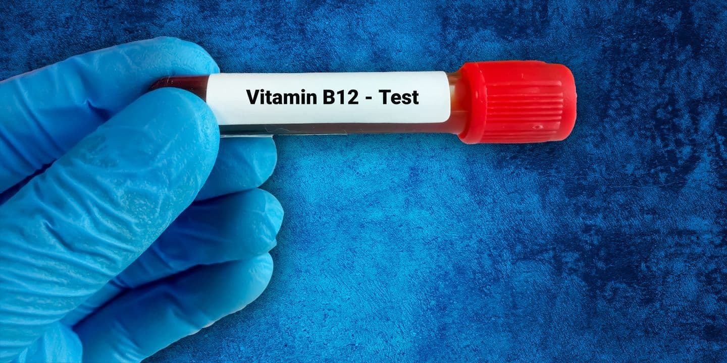 Be Aware of the Importance of Vitamin B12 Test