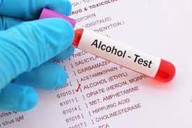 Alcohol Testing in Greater Toronto Area