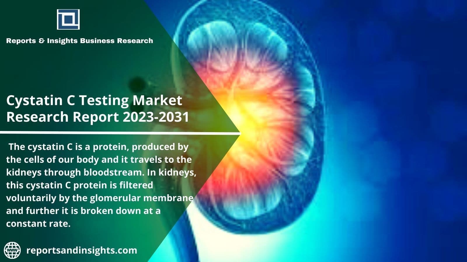 Cystatin C Testing Market Trends and Challenges 2023