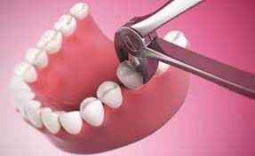 When to Call and What Qualifies as a Dental Emergency?