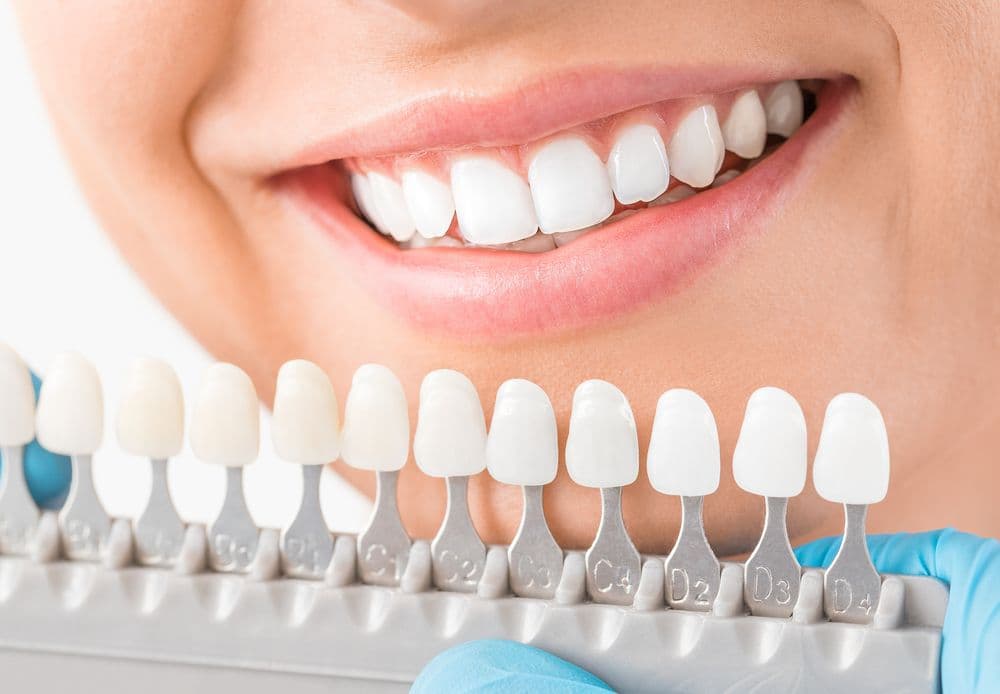 How to find the best aesthetic dentistry near me