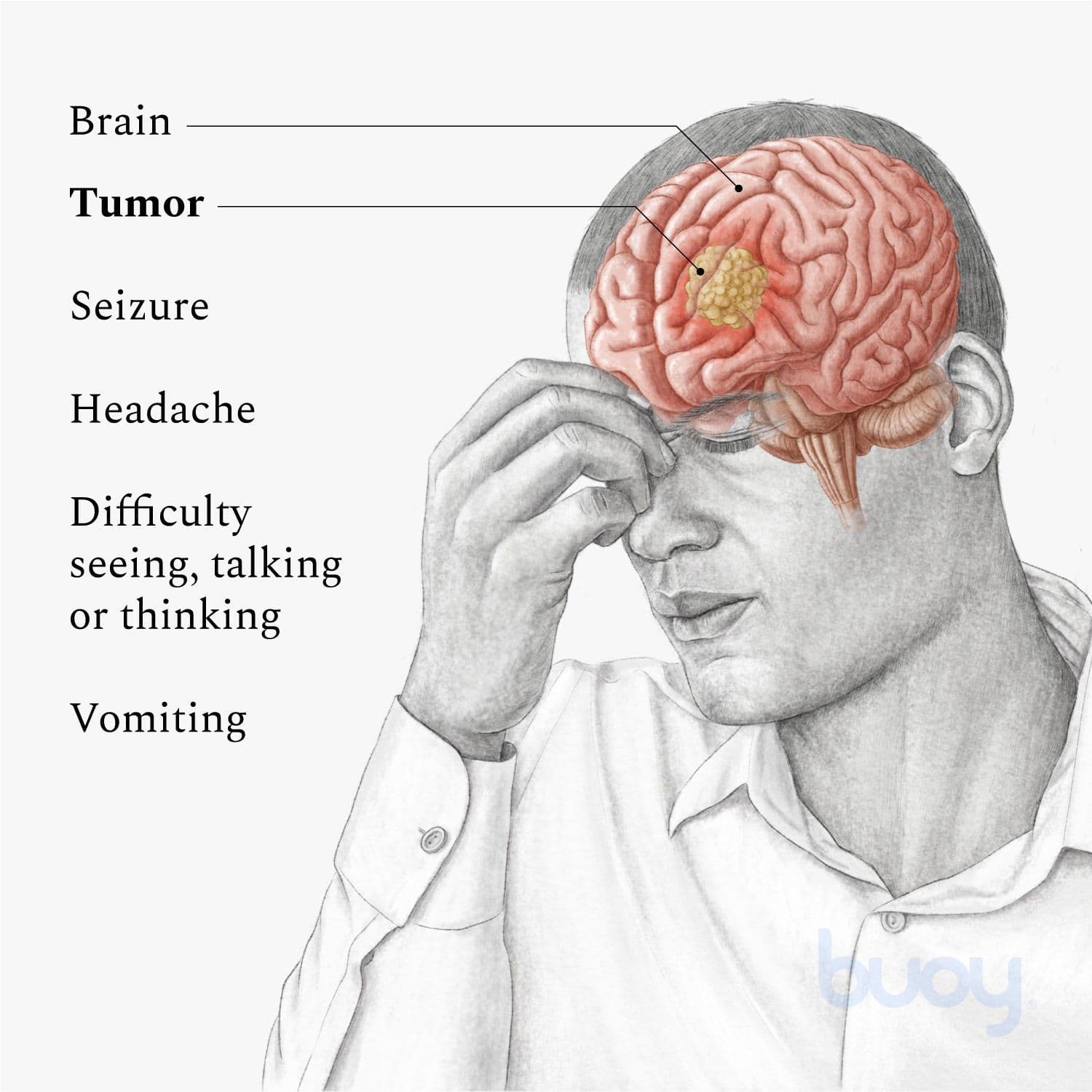 Most Common Brain Tumor: 7 Things You Should Know