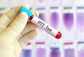 Activated Partial Thromboplastin Test Market Analysis Report