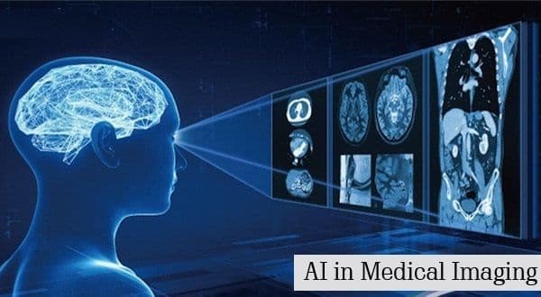 Artificial Intelligence in Medical Imaging Market Growth 2028