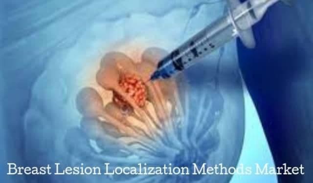 Breast Lesion Localization Methods Market Growth Research Report