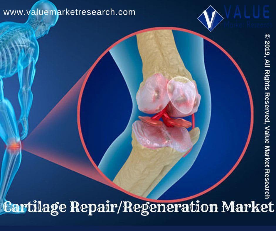 Cartilage Repair/regeneration Market Growth | Analysis Report