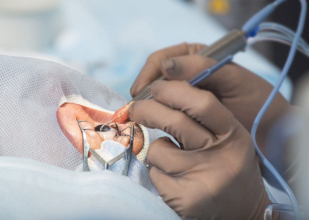 Cataract Surgery Devices Market: Industry Outlook Research Report