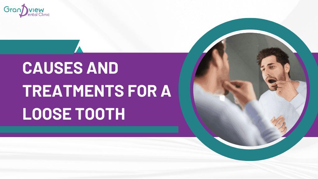 Causes and Treatments for a Loose Tooth