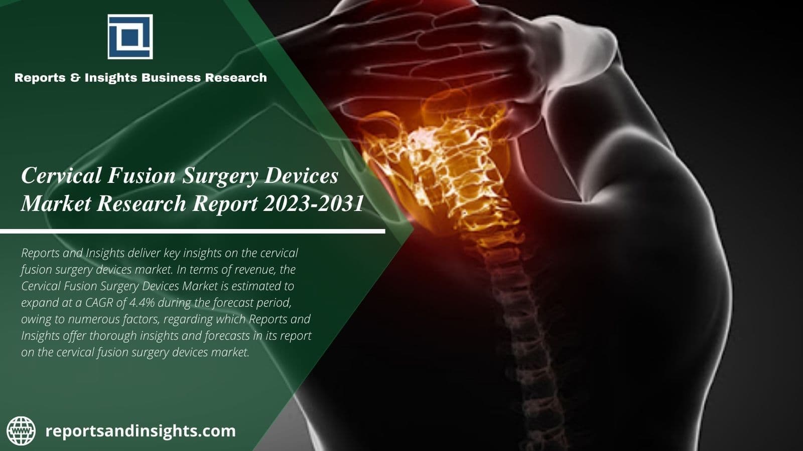 Cervical Fusion Surgery Devices Market Worth Cagr 4.4% by 2031