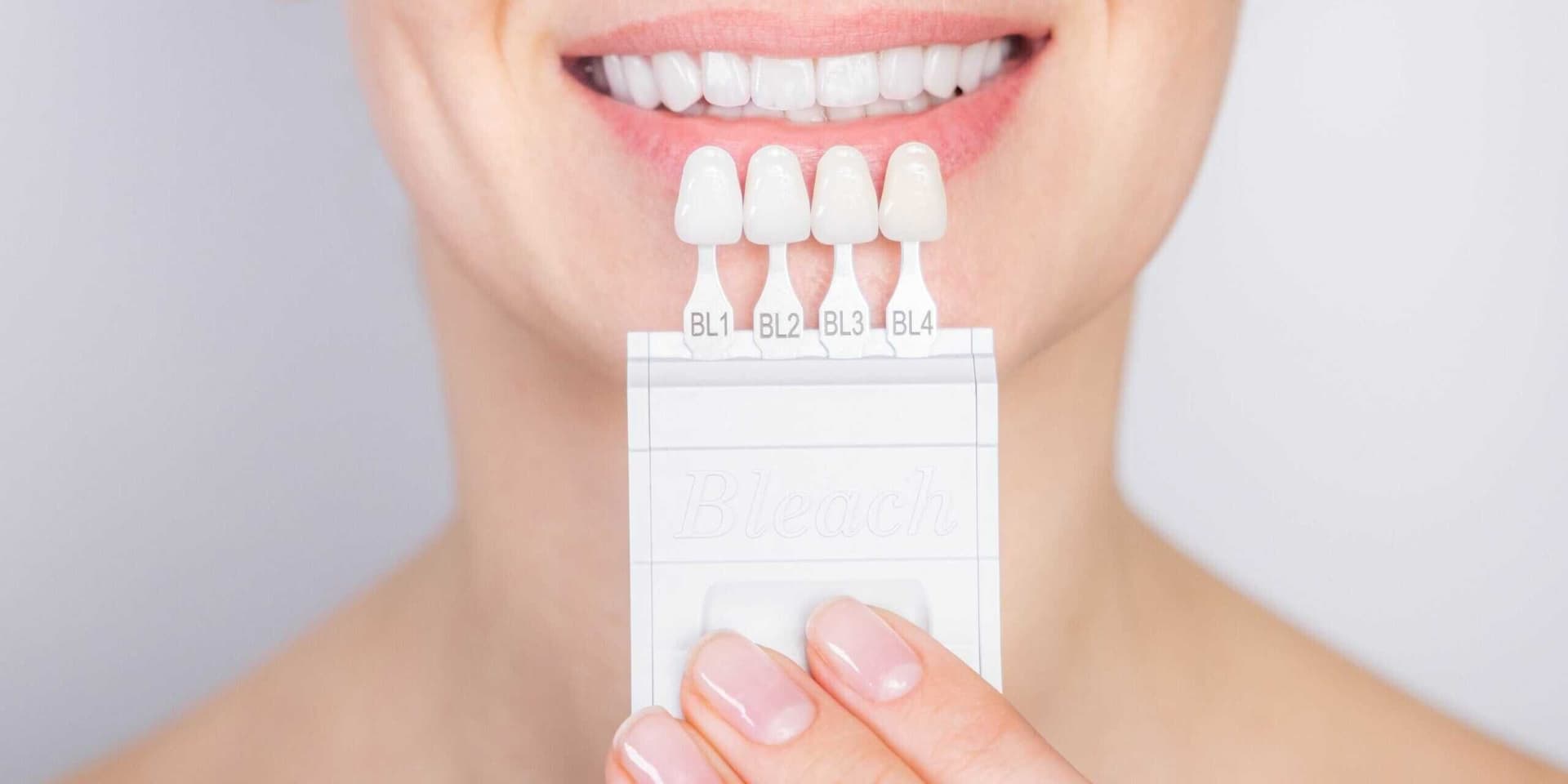 Cost of Dental Veneers Differs from Traditional Braces