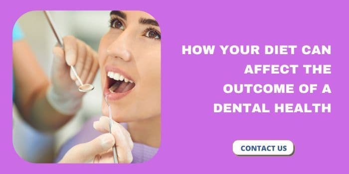 How Your Diet Can Affect the Outcome of a Dental Check-Up