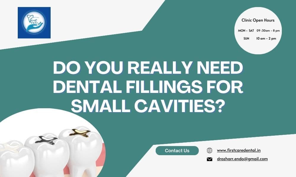 Do You Really Need Dental Fillings for Small Cavities?