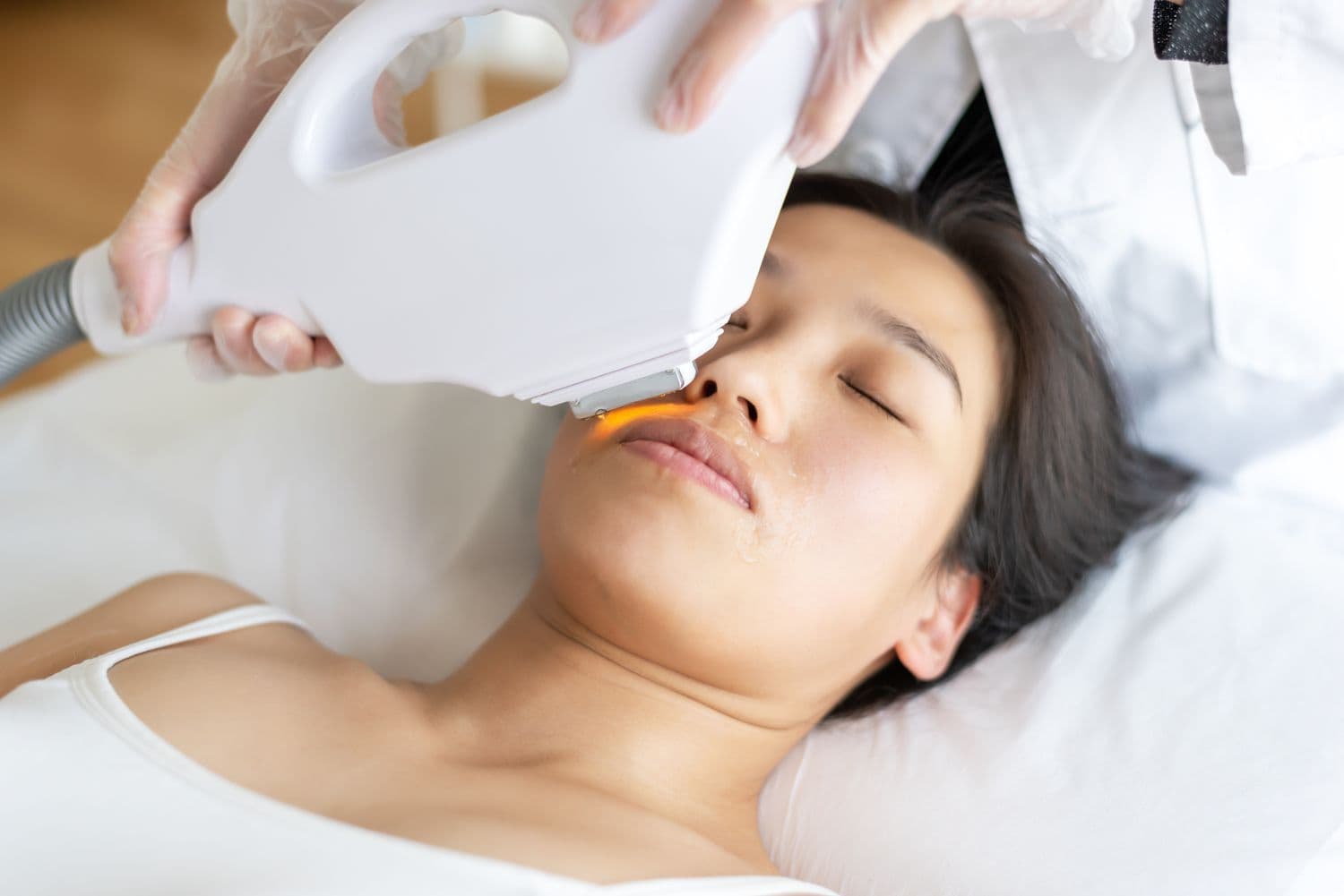 Electrolysis Hair Removal: The Best Treatment for Fine Hair