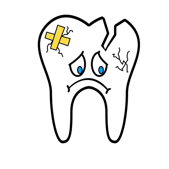 Tooth Decay Explained