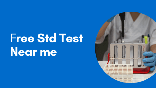 Points to Consider Before You Look for a Free Std Test Near Me