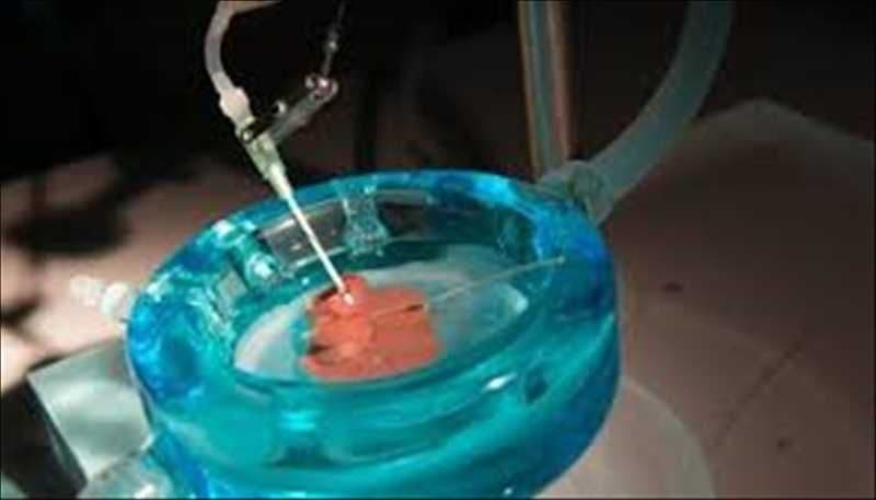 Global Organ Preservation Market Report by Size, Research, Shares