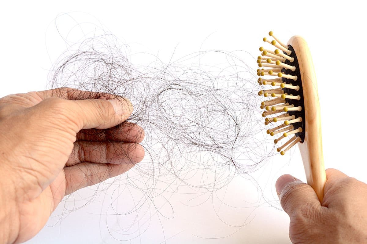 Hair Loss Treatment: How to Prevent Future Hair Loss