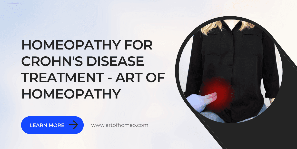 Homeopathy for Crohn's Disease Treatment - Art of Homeopathy