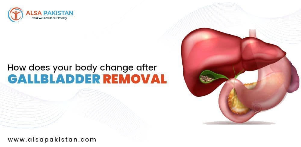 How Does Your Body Change After Gallbladder Removal?