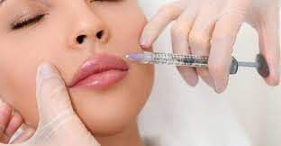 Hyaluronic Acid Based Dermal Fillers Market Growth | Report