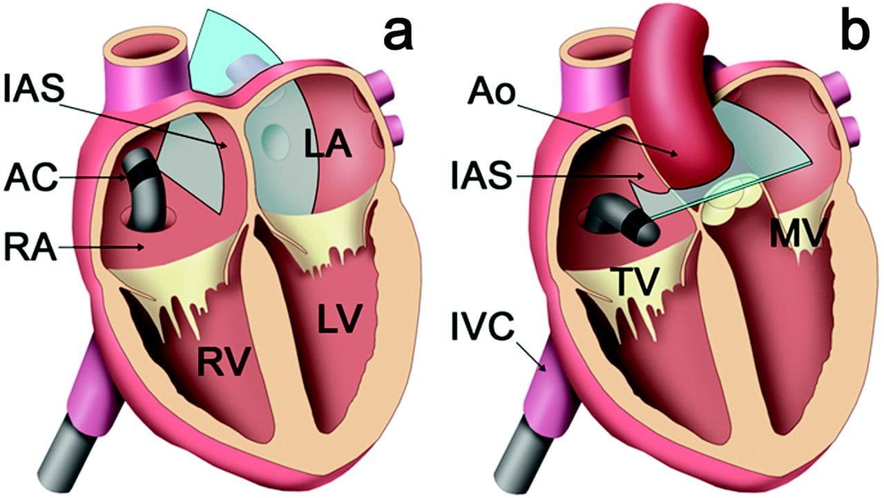 Intracardiac Echocardiography & Intravascular Ultrasound Market