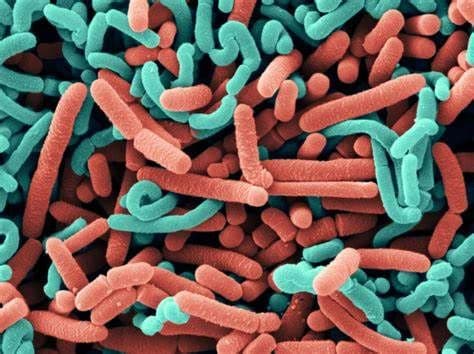 Lactobacillus Probiotics Market Forecast 2022-2028