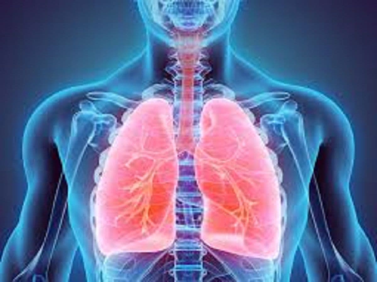 Malignant Pleural Mesothelioma Market Trends, Forecast to 2028
