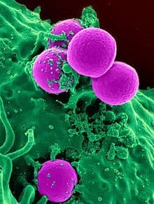 Methicillinresistant Staphylococcus Aureu Treatment Market Share