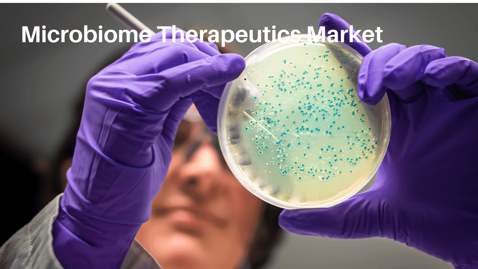 Microbiome Therapeutics Market Size, Growth and Forecast 2030