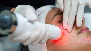 Non-Invasive Aesthetic Treatment Market Outlook to 2028