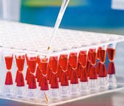 Polymerase Chain Reaction Consumables Market Forecast Report