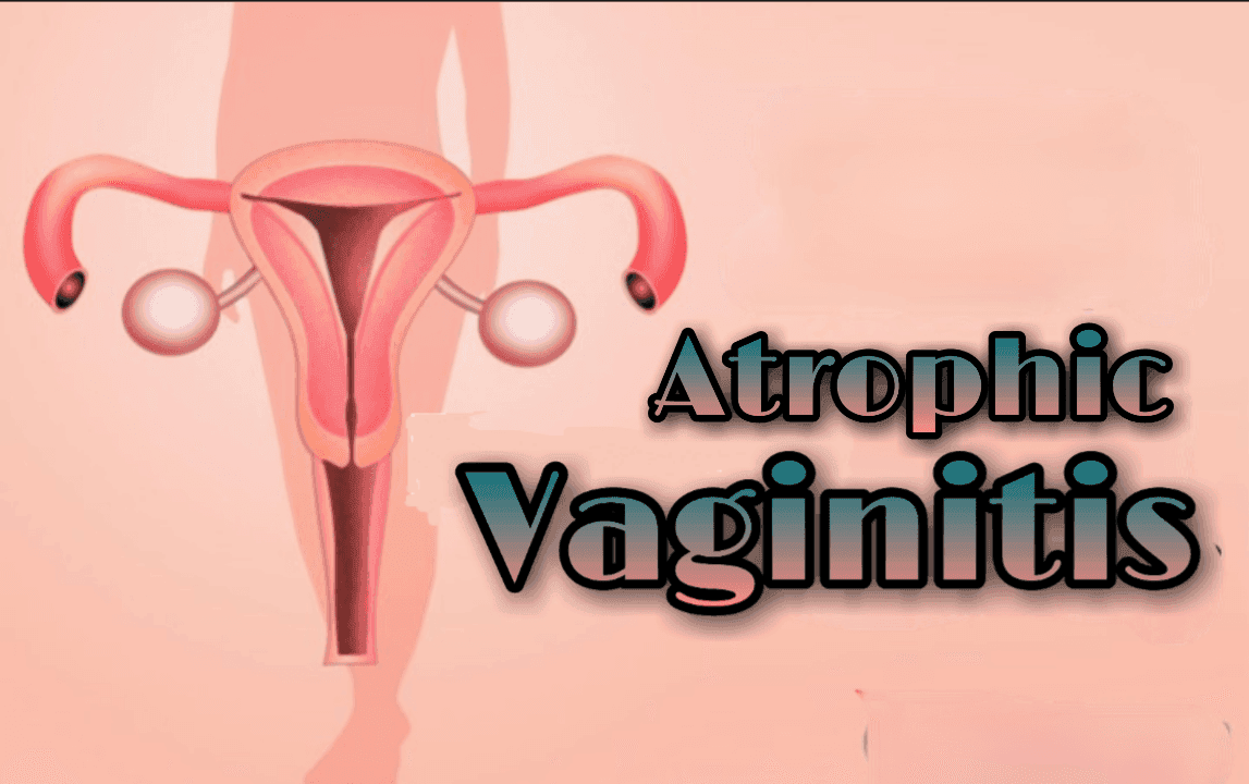 Postmenopausal Vaginal Atrophy Drugs Market Report, Latest Trends