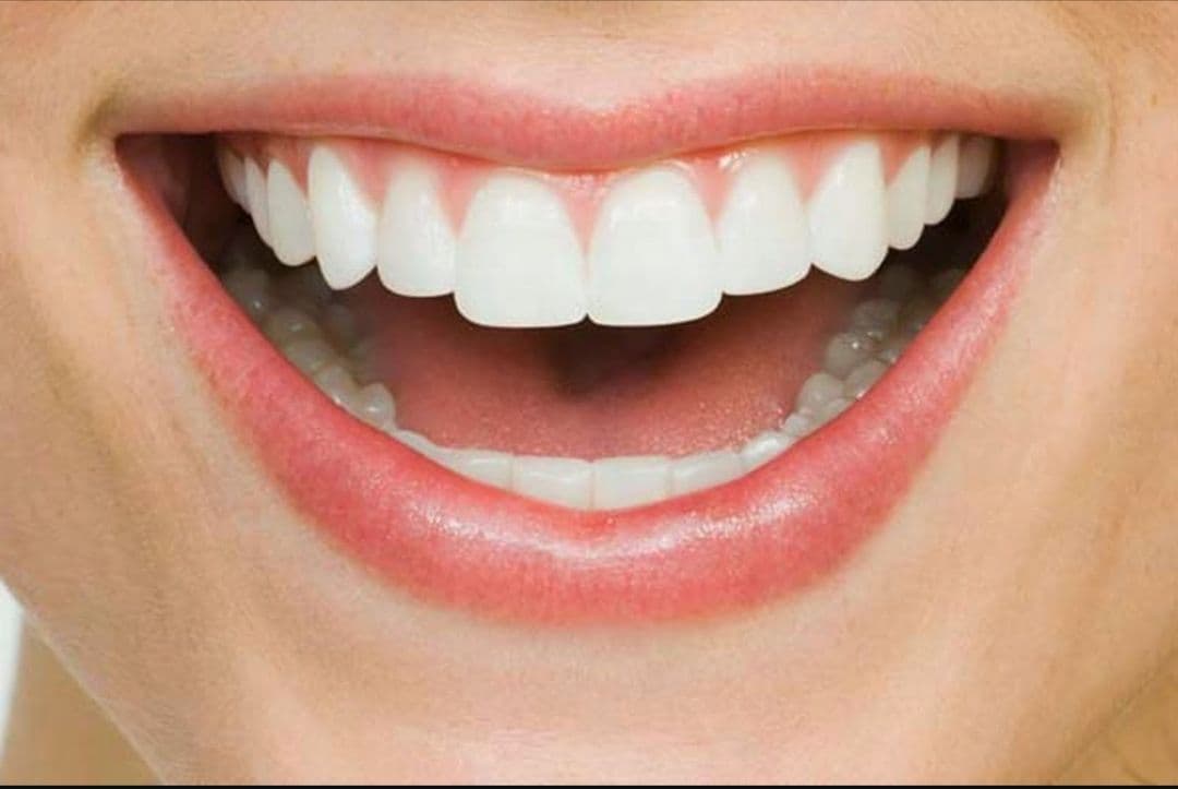 Perfect Smile: Transform Your Teeth With Stunning Veneers in Bali