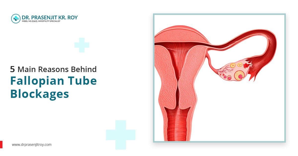 5 Main Reasons Behind Fallopian Tube Blockages