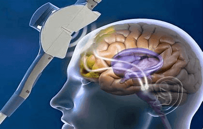 Transcranial Electrical Stimulators Market | Industry Size 2028
