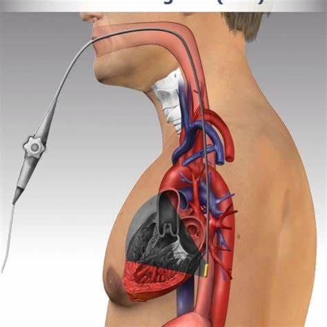 Transesophageal Echocardiography Market – Exclusive Reports