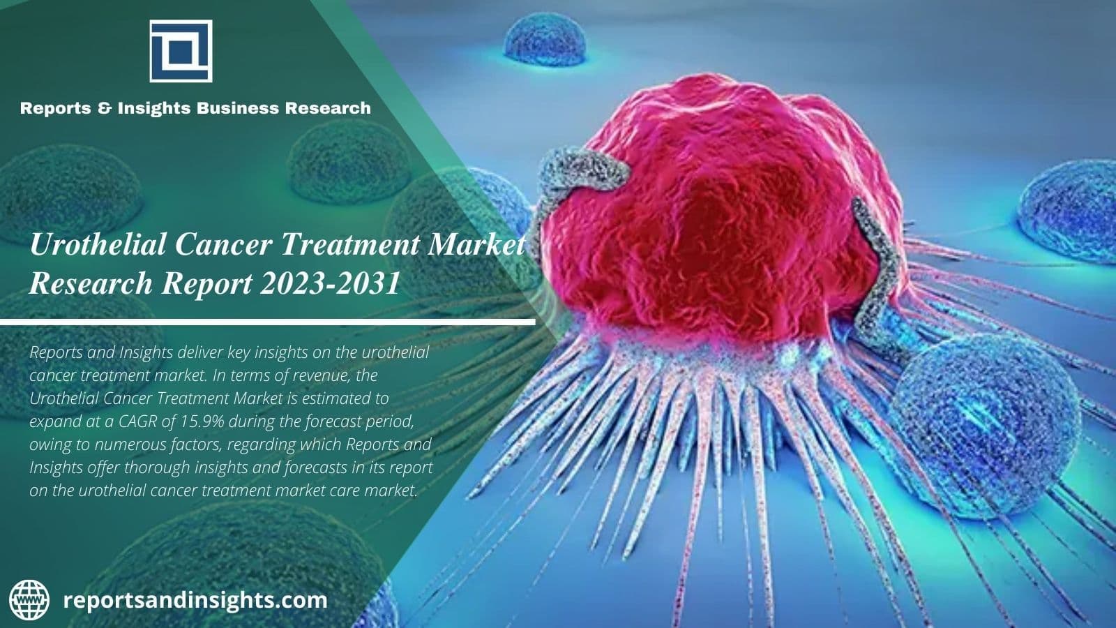 Urothelial Cancer Treatment Market Is Expand at a Cagr of 15.9%.
