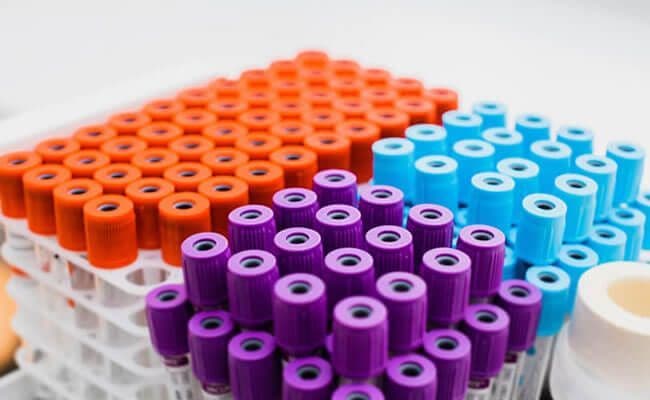 Venous Blood Collection Tube Market – Exclusive Industry Reports