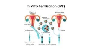 Ivf Success Rates: Specialist & Clinic Impact