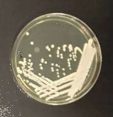 Yeast Extract Peptone Dextrose Mediums Market Report 2028