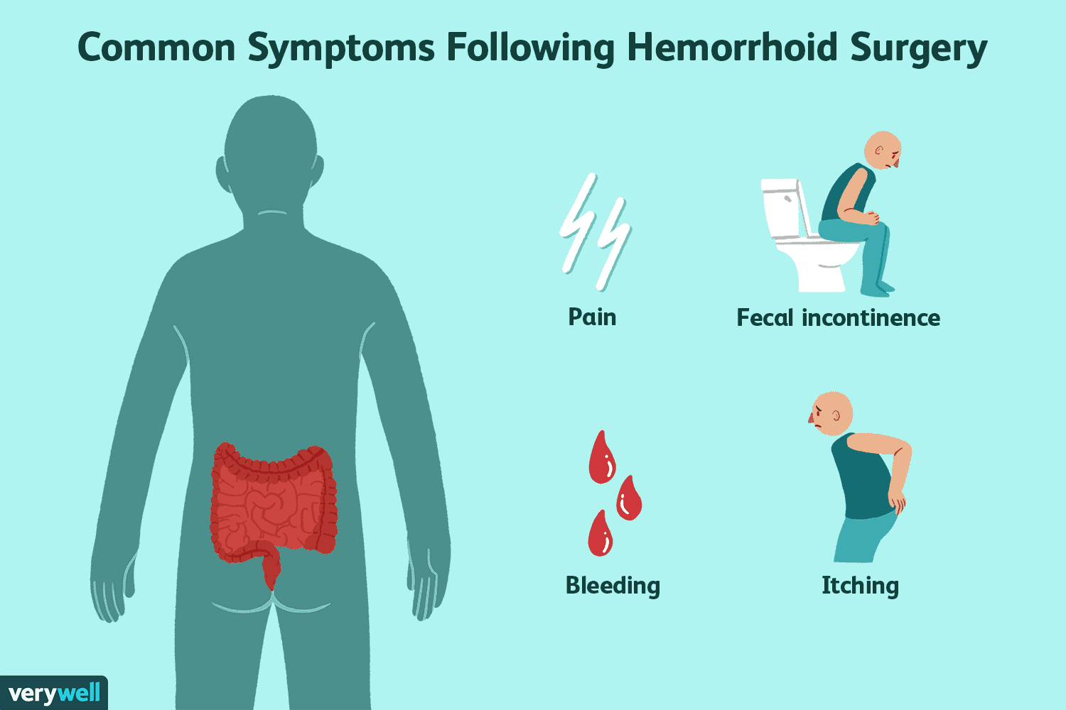 Best Foods for Hemorrhoids: A High-Fiber Diet
